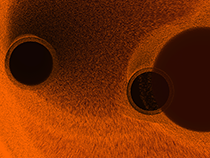 ThreeSuns_preview